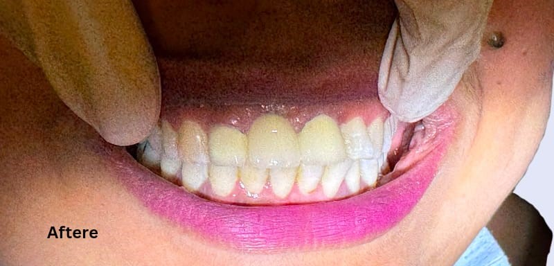 Smile result