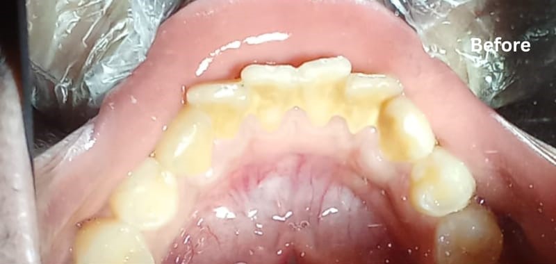 Smile result